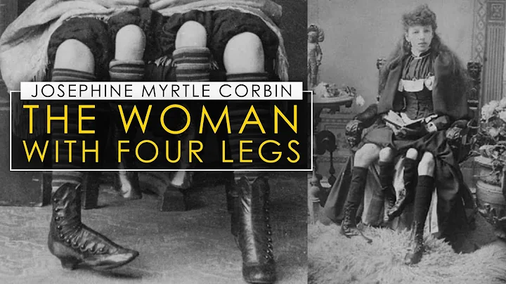 Josephine Myrtle Corbin | The Four Legged Woman
