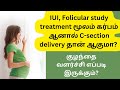Treatment மூலம் pregnant ஆனால் C-section தான் ஆகுமா?