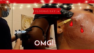 VLOGMAS DAY 15 | BUTT INJECTIONS, ROUND 2! • THEY SAY BEAUTY IS PAIN