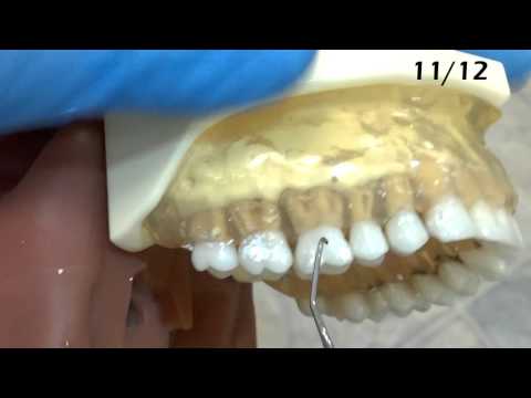 gracey instrumentation basics | Gracey Instrumentation Basics