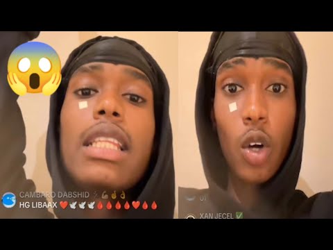 CANADIAN BOY OO DHAHAY QAWIILKA HOOYADEYDA HG WAAN KA FAANAA IYO SABABTA DAAWO