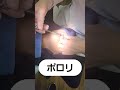 金属土台の除去です。少しの力を加えるだけで取れてきました。今後根っこの再治療をして白い土台(ファイバーとレジン)で補強していきます#セラミック#差し歯#銀歯#ダイヤモンド今井