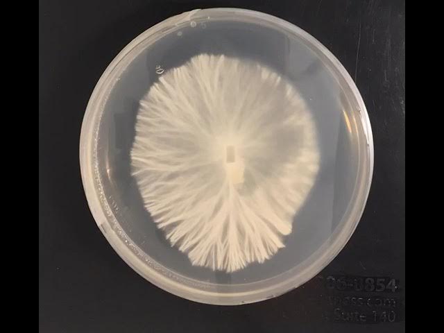 Best mushroom time lapse 14 day mycelium Petri dish grow beautiful hyphae and full plate magic