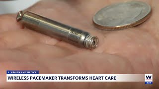 Wireless pacemaker transforms heart care