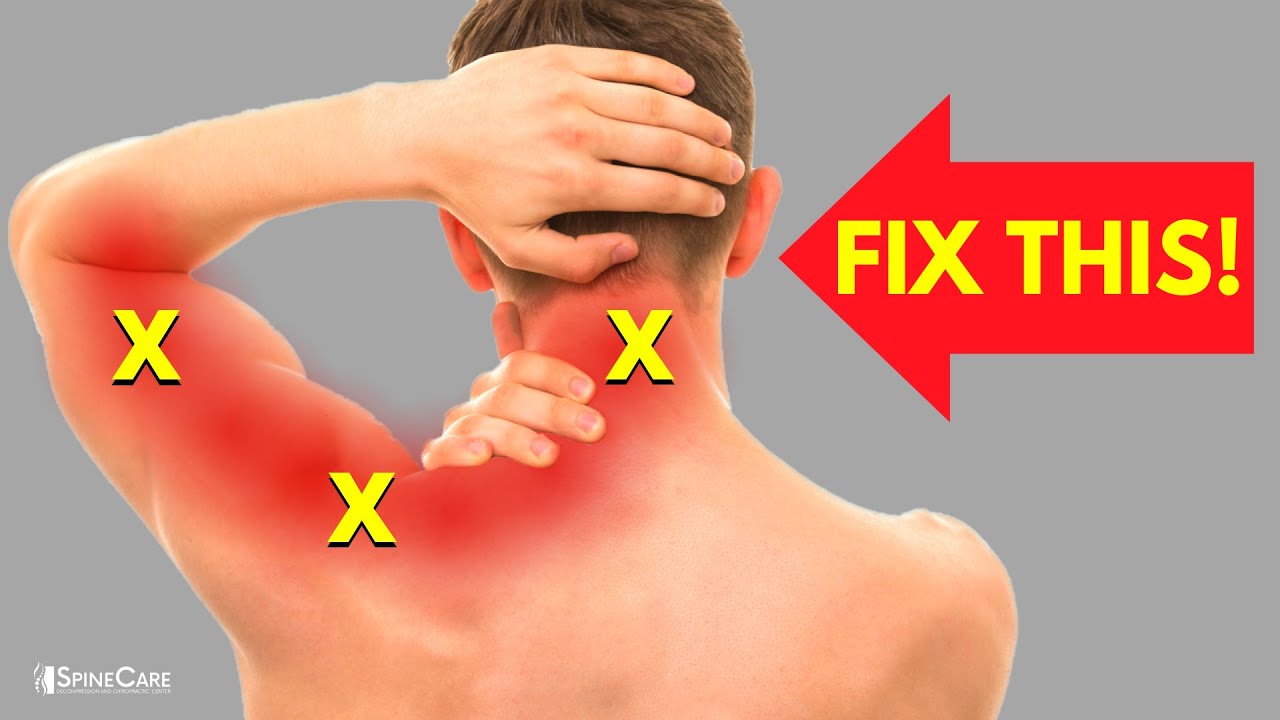 How to INSTANTLY Fix Pinched Nerve Pain in the Neck and Shoulders 