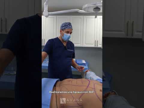 Video Before & after Macho makeover | Dr Mameniskis | Miami, Fl | Avana Plastic Surgery