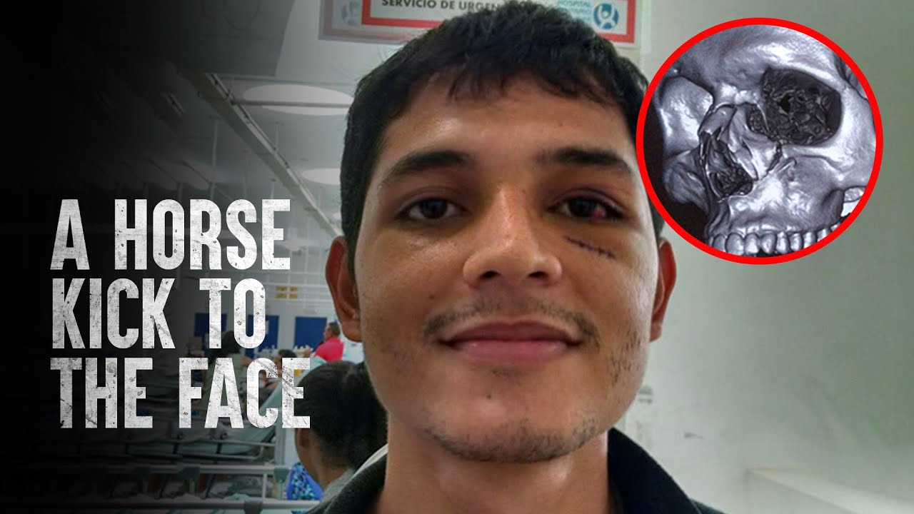 How to Survive a Horse Attack YouTube