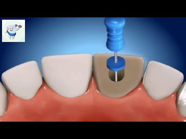 Parekh Dental Care - 08048037002
