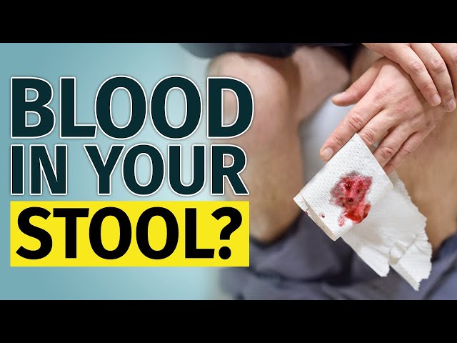 When to Worry about Blood in Stool?