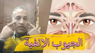 التهاب الجيوب الانفية وعلاجه