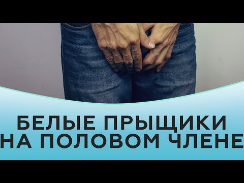 Белые прыщики на половом члене