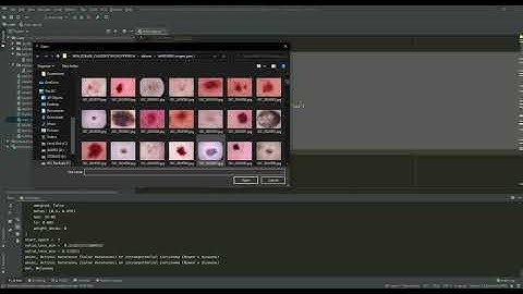 SKIN DISEASE CLASSIFICATION using PYTORCH | Machine Learning | Project | Python Language