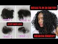 I&#39;M STILL SHOCKED! CRAZY RESULTS WITH RECEIPTS! HOW TO: STOP HAIR FALL AND REGROW EDGES