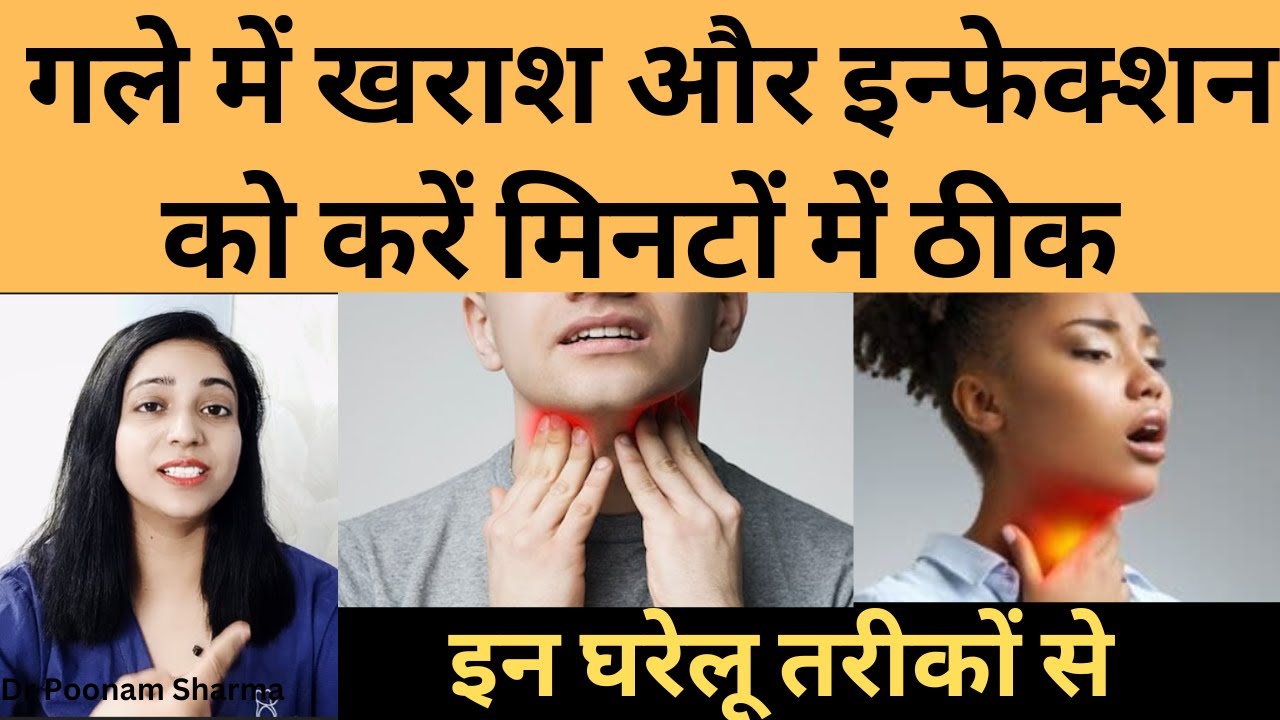 home-remedies-for-throat