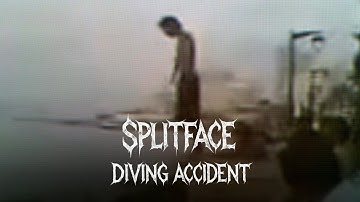 Face Split Diving Accident: The Viral Video That Terrified the Internet