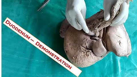 Duodenum dissection & Demonstration - Simplified & made easy for beginners