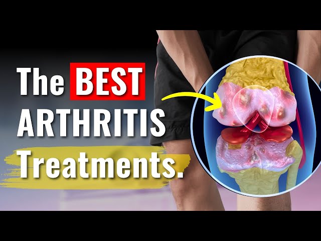 Knee Arthritis Treatments That ACTUALLY Work: The In-Depth Truth You Need to Know class=