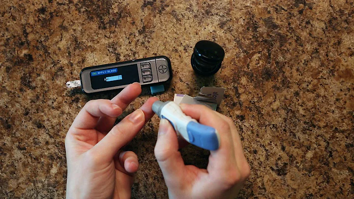 Cystic Fibrosis Related Diabetes