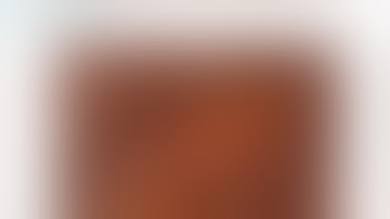 20120313_Hội chứng tắc ruột