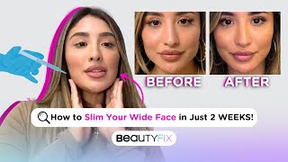 How to STOP Clenching Your Jaw With BOTOX | BeautyFix