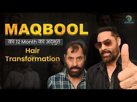 Shaji Hair Transplant | Celebrity Hair Transplant Clinic in India |Celebrity Hair Transplant Surgeon - video from Dermalife