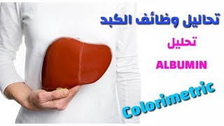 تحليل Albumin .الزلال فى الدم . تعليم التحاليل الطبية للمبتدئين