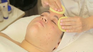 Diet Related Acne And Facial With Alessandra Part 2