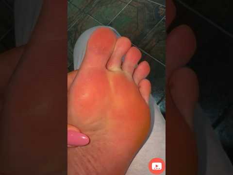 Pesda Brazilian Big Feet Sweaty Sole Flip Flops 37 SHORTS 