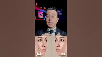 كريم السحر اللي هايغير بشرتك 