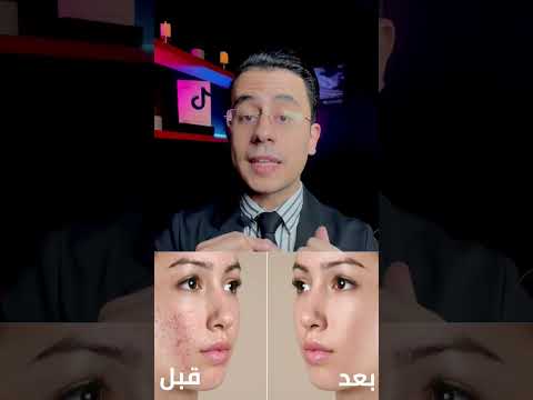 فيديو: هل يعمل الكريم السحري المصري على تفتيح البشرة؟
