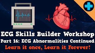 Electrocardiogram (ECG) Skills Builder Workshop Part 16: ECG Abnormalities Continued