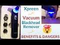 Xpreen Vacuum Blackhead Remover Review- Benefits and Dangers