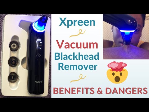 Xpreen Vacuum Blackhead Remover 검토-이점 및 위험