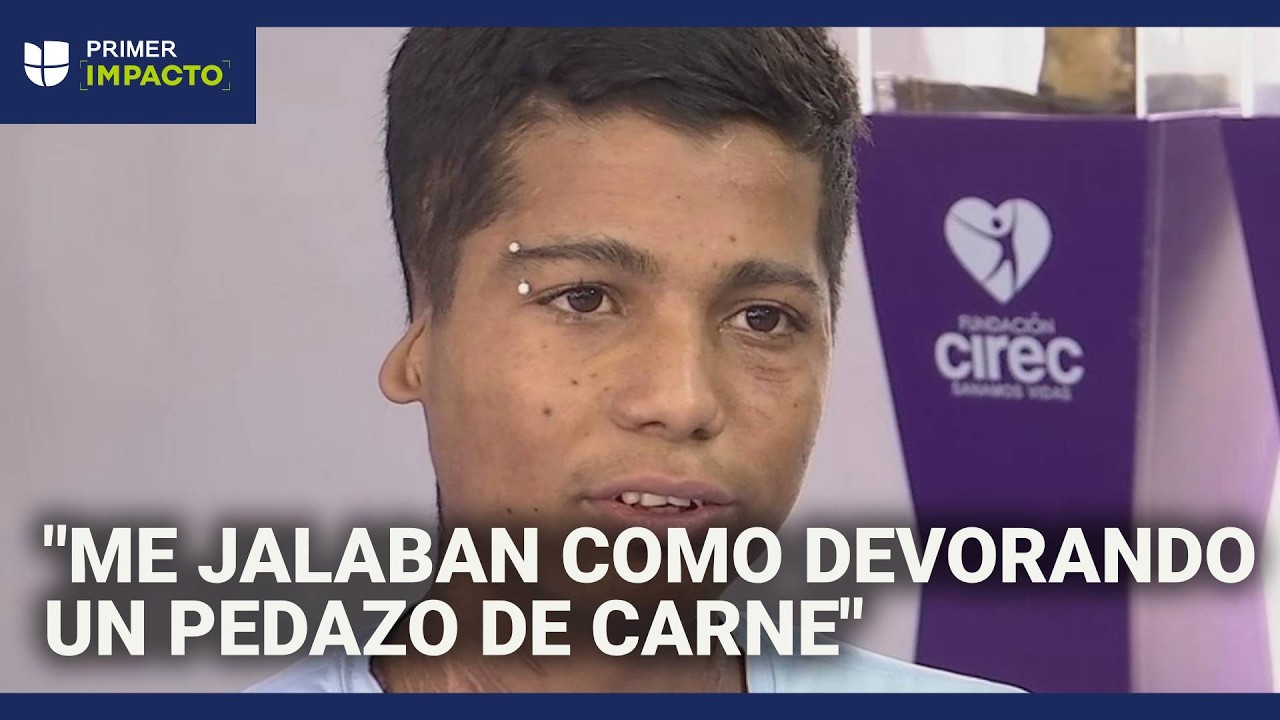 Lo atacó manada de perros y perdió los brazos y orejas: joven narra cómo fue el dramático momento