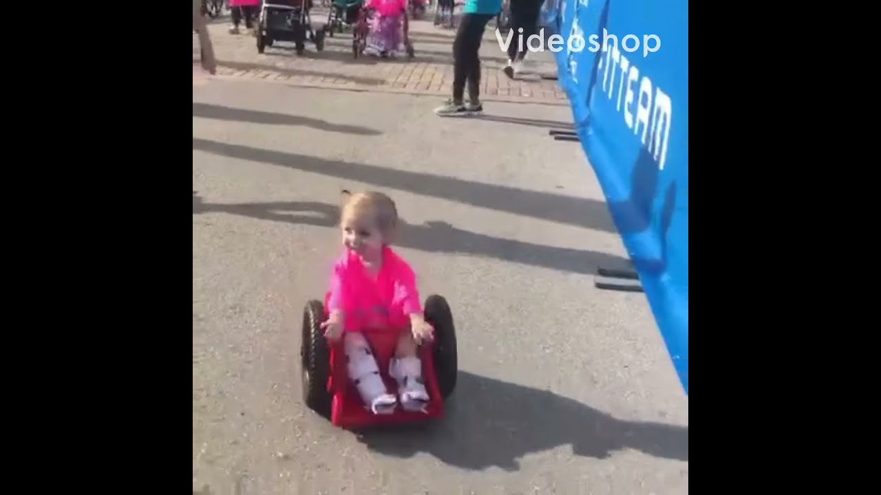 Larsen Syndrome Diagnosis and Treatment / Patient Testimonial: Gianna