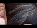 #traditional way to# long hair licepicking#nitpicking