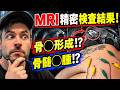 MRI精密検査の結果が判明…そしてイギリス人が人生初の「鍼＆電気鍼」に挑戦！😱⚡️