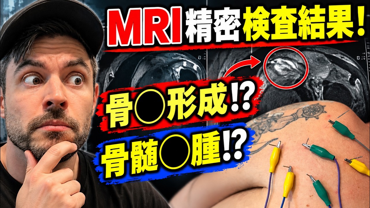MRI精密検査の結果が判明…そしてイギリス人が人生初の「鍼＆電気鍼」に挑戦！😱⚡️