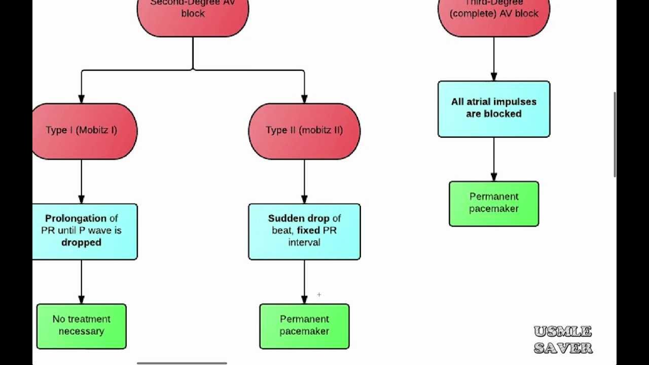 Cardiac Arrhythmia Chart