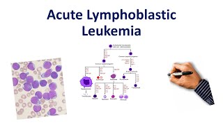 Acute Lymphoblastic Leukemia Mnemonic