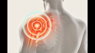 Causes and Treatments for Shoulder Instability | Michael Redler, MD