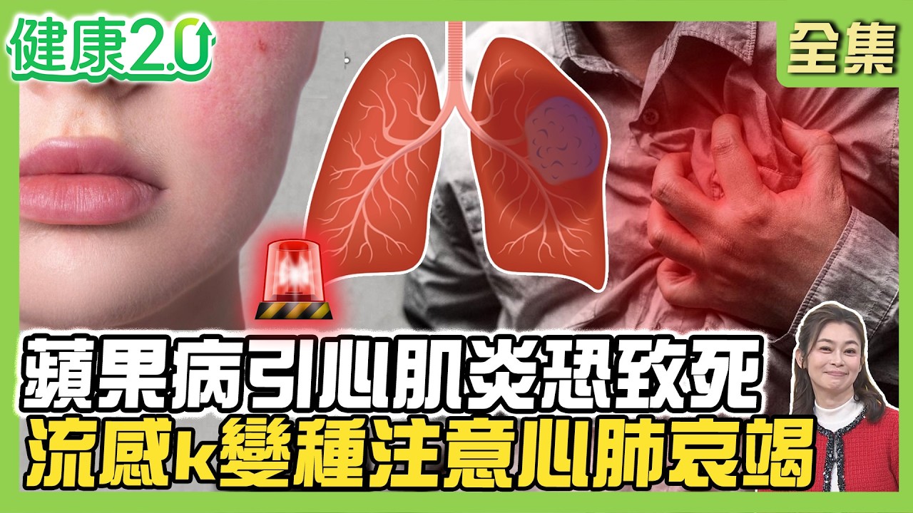 女童疑蘋果病B19病毒奪命 症狀像感冒 併發心肌炎致死率達3成！流感K變種太毒恐心肺衰竭！皮膚白、指甲黑3個心肺衰竭訊號！健康2.0 20260228【完整版】#鄭凱云#徐克強#莊海華#林舜穀#陸巧因