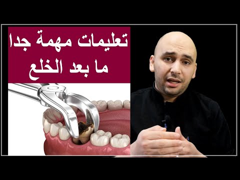 فيديو: هل يجب إزالة الأسنان الفاسدة؟