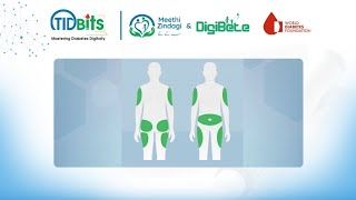Insulin Injection Sites Meethi Zindagi