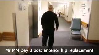 Mr MM Day 3 post anterior hip replacement