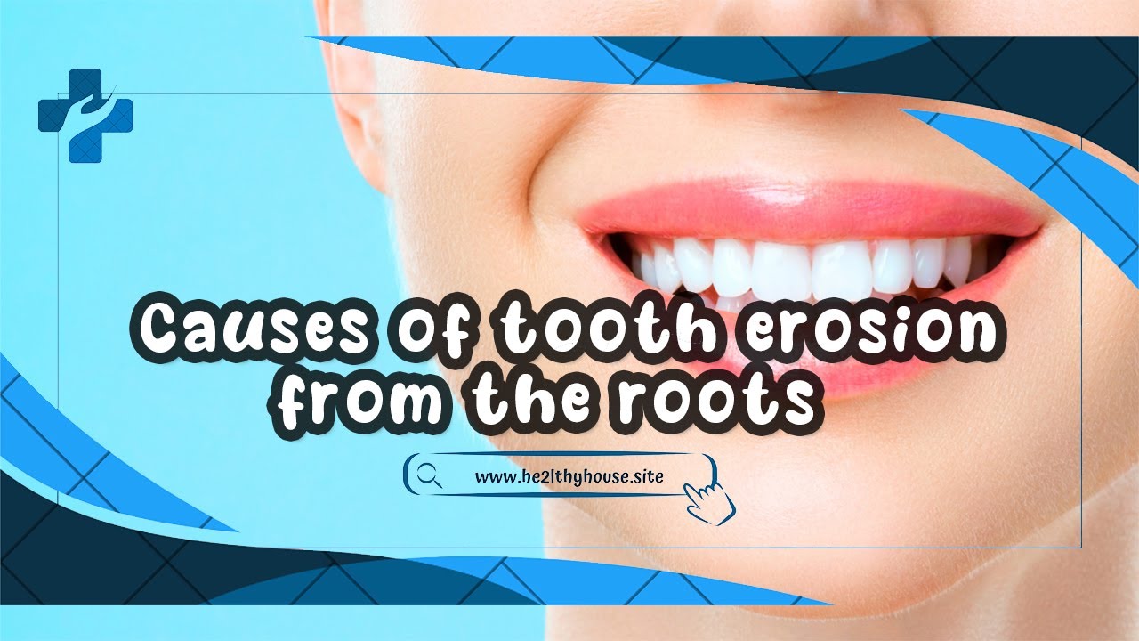 Causes of tooth erosion from the roots - YouTube