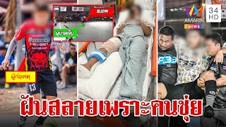 ฟุตซอลสายเถื่อน นักเตะดาวรุ่งถูกเตะขาหัก 2 ท่อน อนาคตดับวูบอดคัดตัว | ทุบโต๊ะข่าว | 24/4/67