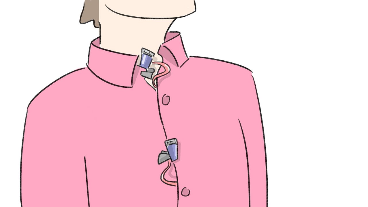 LIS Microfonatura doppia definizione