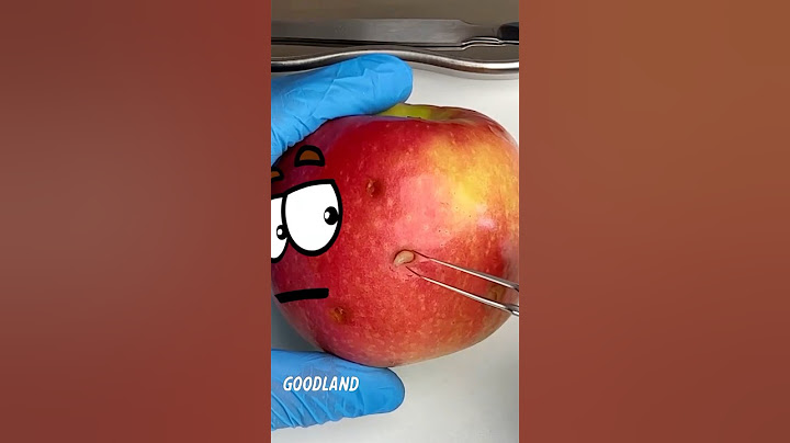 Goodland | Apple surgery 😳#goodland #shorts #doodles #doodlesart