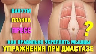 Смотреть видео  если не сошлись мышцы белой линии живота